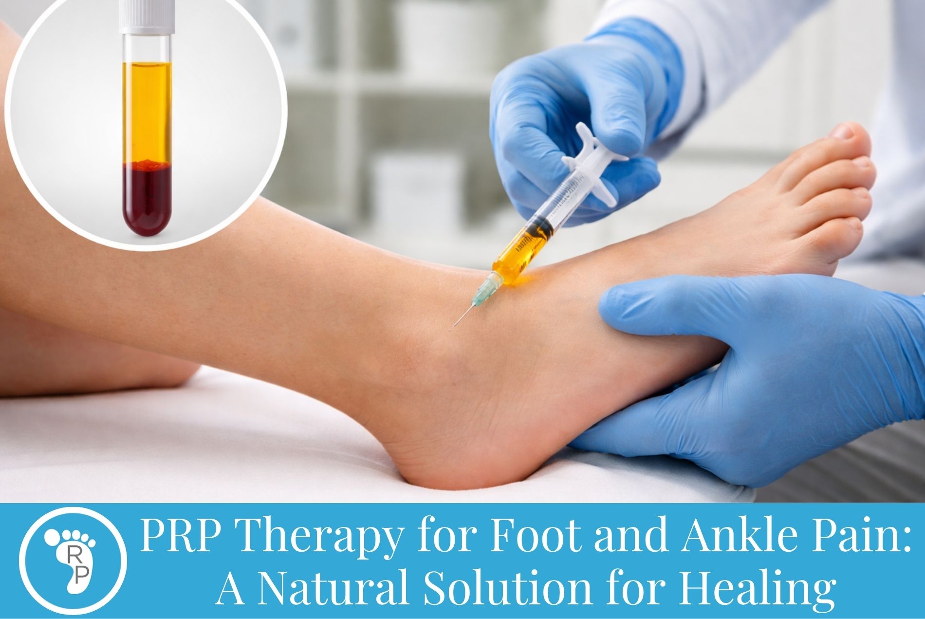 PRP Therapy for Foot and Ankle Pain: A Natural Solution for Healing